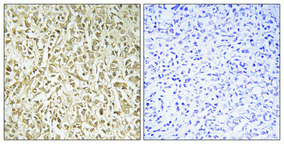 a00959 poll primary antibodyes ihc testing 2
