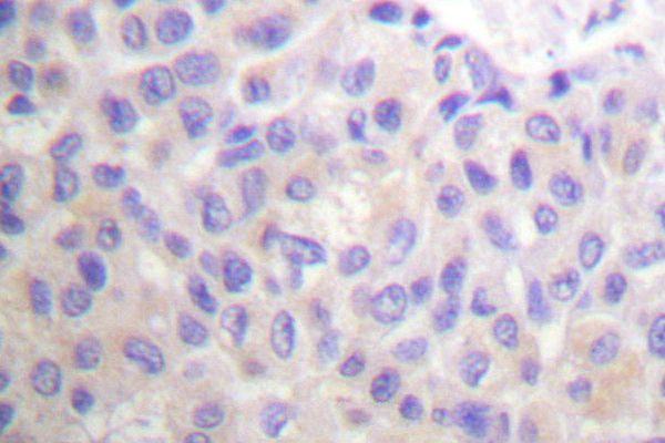 a00960 1 bcar1 primary antiboties ihc testing 2