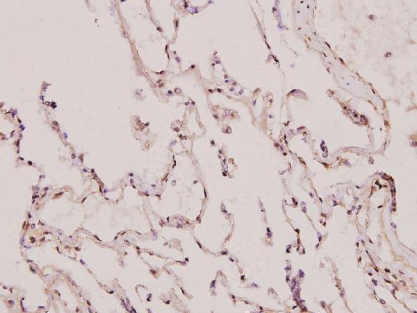 a00960 bcar1 primary antiboties ihc testing 2