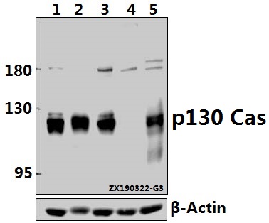 a00960 bcar1 primary antiboties wb testing 1