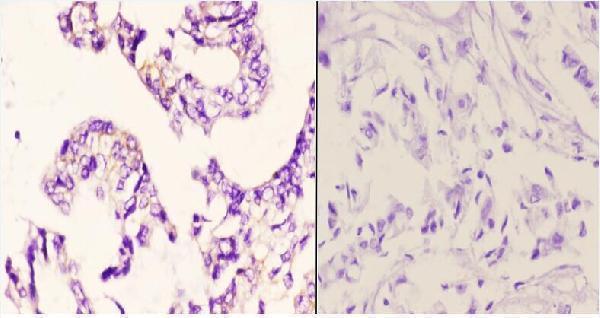 a00960y249 1 bcar1 primary antiboties ihc testing 2