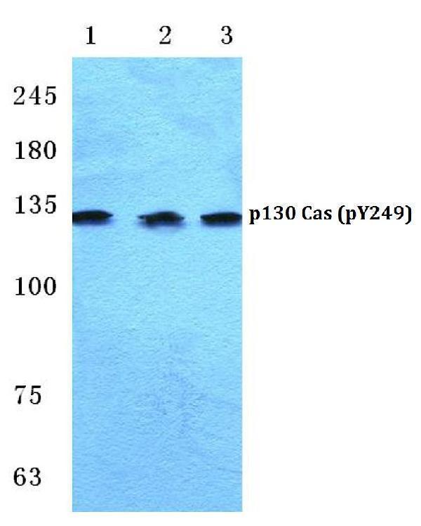 a00960y249 1 bcar1 primary antiboties wb testing 1