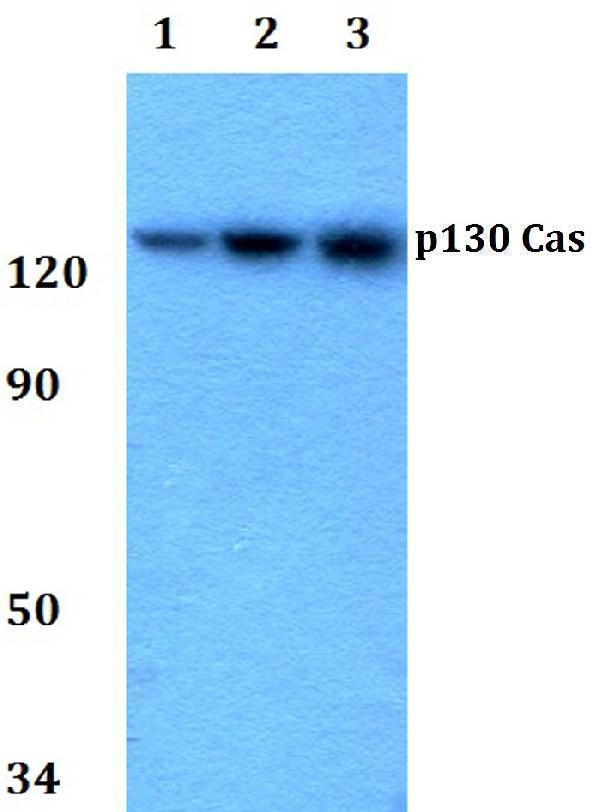 a00960y249 bcar1 primary antiboties wb testing 1