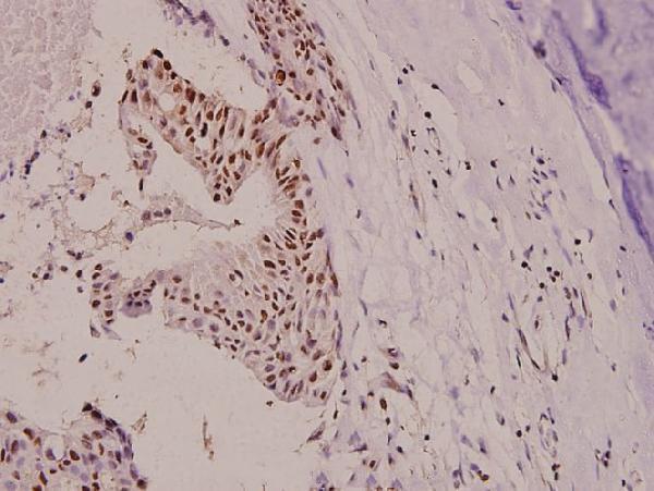 a00960y410 bcar1 primary antiboties ihc testing 2