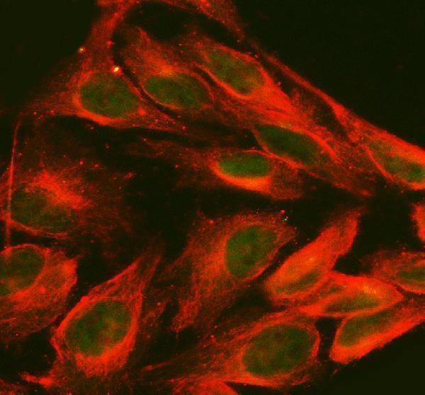 a00962 2 foxc1 primary antibodies if testing 2