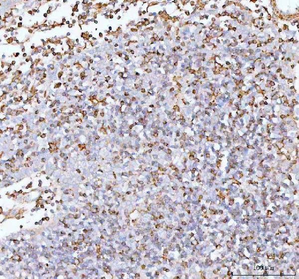 a00963 1 il22 primary antibodies ihc testing 3