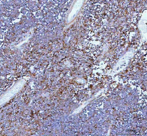 a00963 1 il22 primary antibodies ihc testing 4