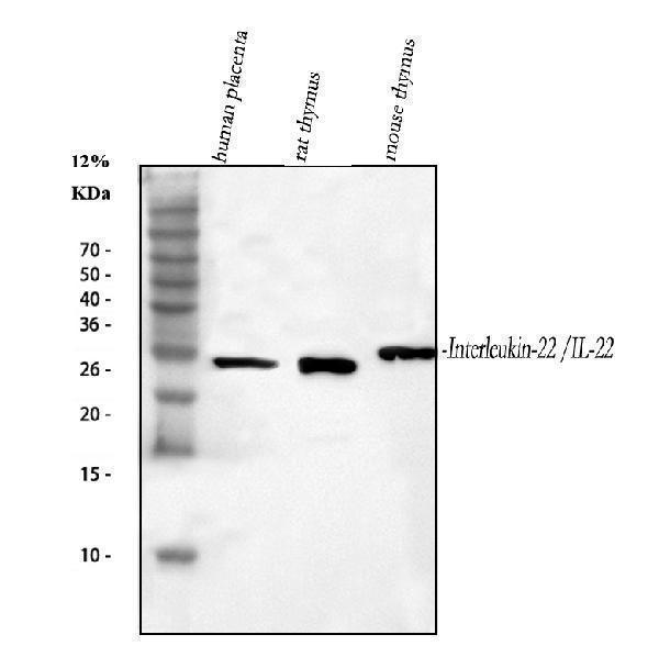 a00963 1 il22 primary antibodies wb testing 1