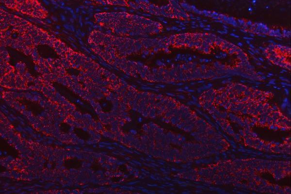 a00965 1 tst primary antibodies if testing 13_1