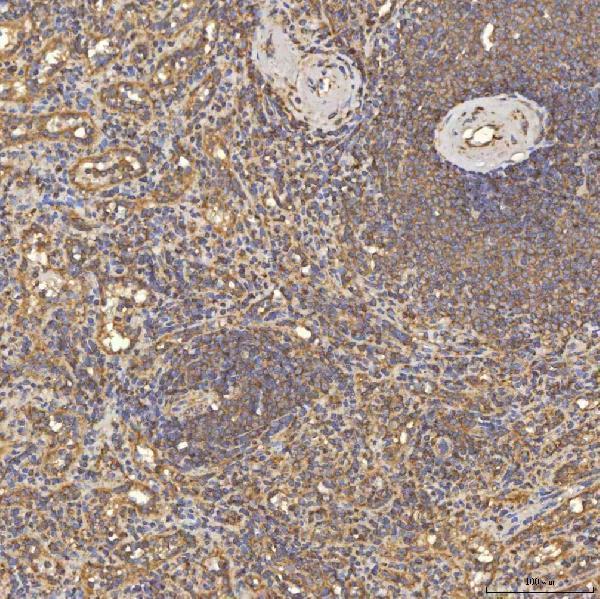 a00965 1 tst primary antibodies ihc testing 10