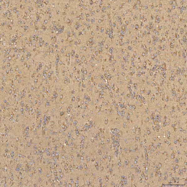 a00965 1 tst primary antibodies ihc testing 11