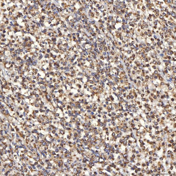  IHC analysis of TST using anti-TST antibody (A00965-1)