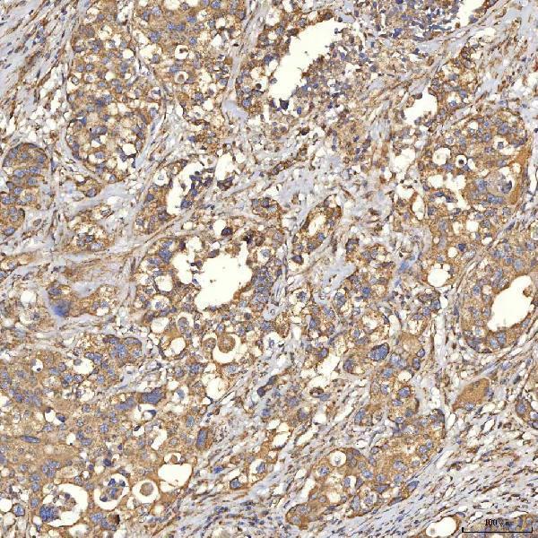  IHC analysis of TST using anti-TST antibody (A00965-1)