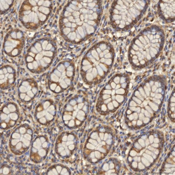 a00965 1 tst primary antibodies ihc testing 4