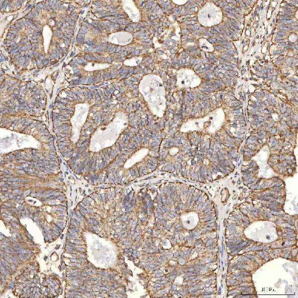 a00965 1 tst primary antibodies ihc testing 5