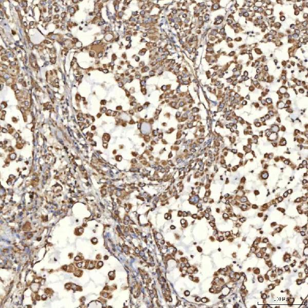 a00965 1 tst primary antibodies ihc testing 6