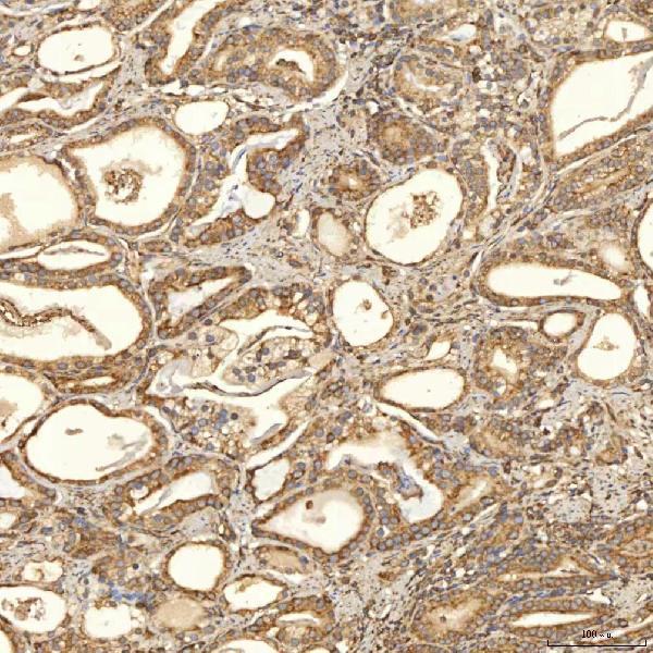 a00965 1 tst primary antibodies ihc testing 8