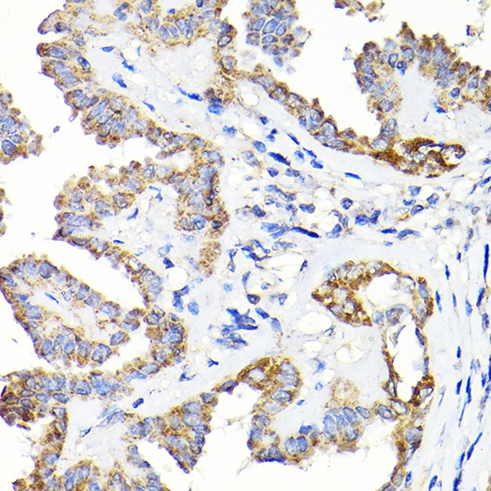 a00965 tst primary antiboties ihc testing 3