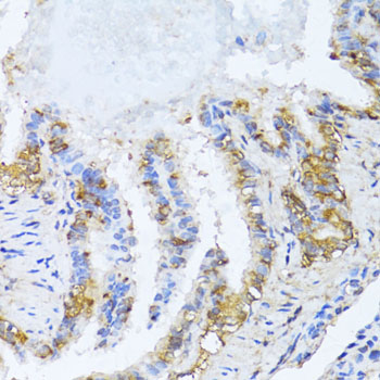 Immunohistochemistry of paraffin-embedded rat lung using NAT2 antibody  at dilution of 1:100 