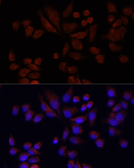 Immunohistochemistry of paraffin-embedded rat heart using NAT2 antibody  at dilution of 1:100 