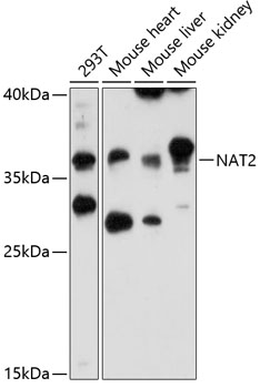 Western blot analysis of extracts of various cell lines, using NAT2 antibody  at 1:3000 dilution