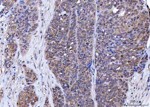 a00967 1 bag6 primary antibodies ihc testing 3_1