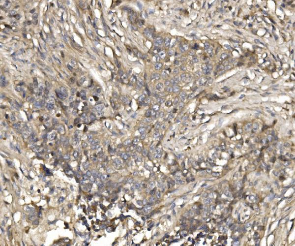  IHC analysis of EIF4EBP1 using anti-EIF4EBP1 antibody (A00968-1)