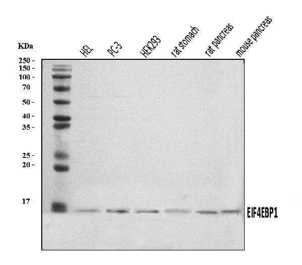  Western blot analysis of EIF4EBP1 using anti-EIF4EBP1 antibody (A00968-1)
