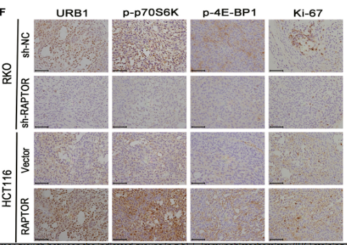 Western blot analysis of lysates from Jurkat cells treated with Insulin 0