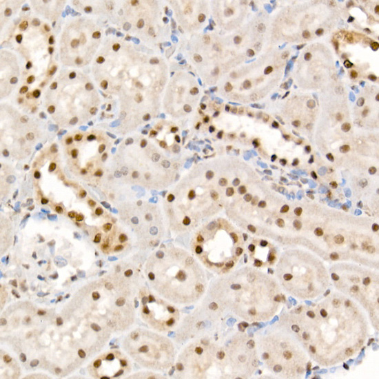 Immunohistochemistry of paraffin-embedded rat kidney using Phospho-eIF4EBP1-T37/46 Rabbit pAb  at dilution of 1:100 