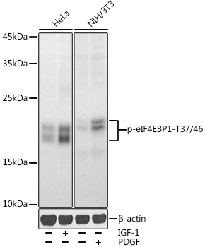 Western blot analysis of extracts of various cell lines, using Phospho-eIF4EBP1-T37/46 antibody  at 1:1000 dilution
