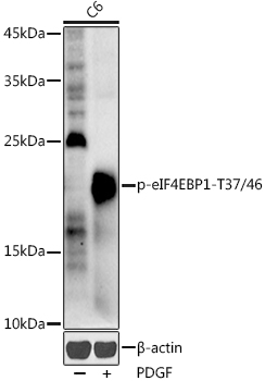 Western blot analysis of extracts of C6 cells, using Phospho-eIF4EBP1-T37/46 antibody  at 1:1000 dilution