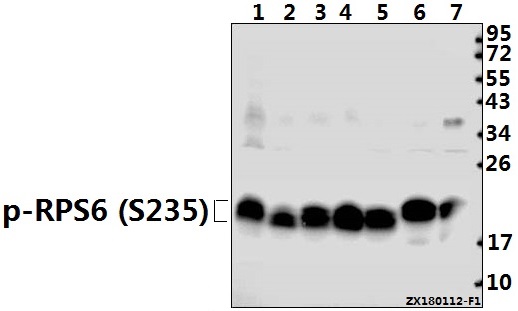 Western blot (WB) analysis of p-4E-BP1 (T46) pAb at 1:500 dilution
Lane1:PC3 whole cell lysate(40ug)
Lane2:HCT116 whole cell lysate(40ug)
Lane3:SGC7901 whole cell lysate(40ug)
Lane4:EC9706 whole cell lysate(40ug)
Lane5:Panc1 whole cell lysate(40ug)
Lane6:3T3-L1 whole cell lysate(40ug)
Lane7:PC12 whole cell lysate(20ug)