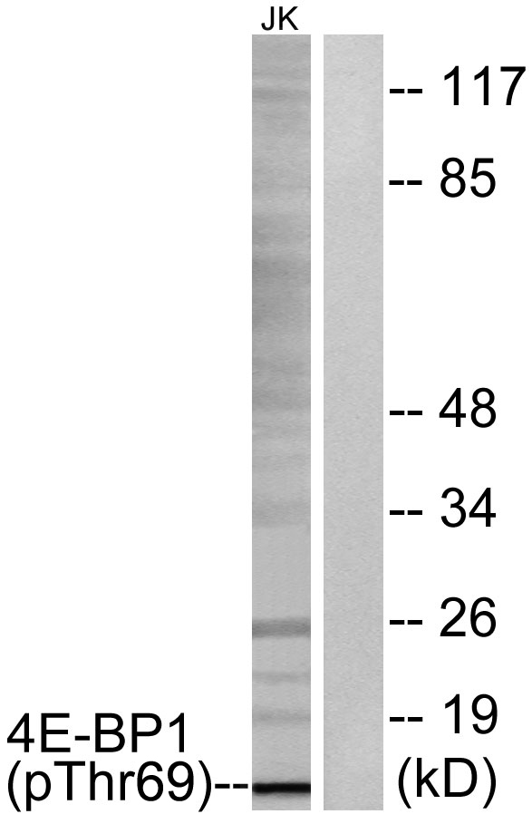 Western blot analysis of lysates from Jurkat cells treated with EGF 200ng/ml 30', using 4E-BP1 (Phospho-Thr69) Antibody