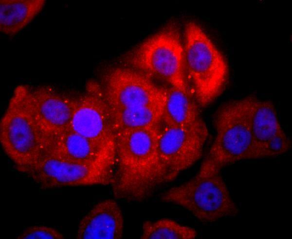 ICC staining NFAT1 in MCF-7 cells (red)