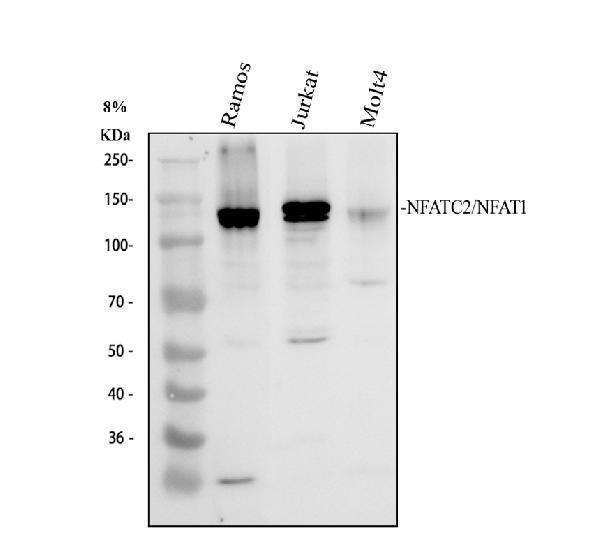 Western blot analysis of NFAT1/NFATC2 using anti-NFAT1/NFATC2 antibody (A00969)