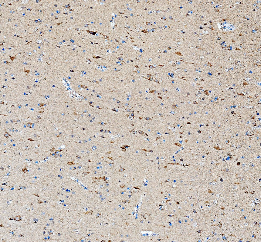IHC analysis of HDAC4 using anti-HDAC4 antibody (A00971-1)