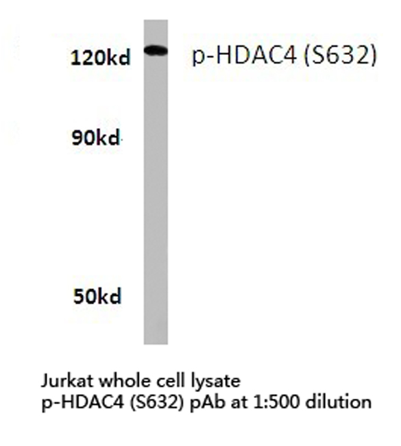 a00971s632 hdac4 primary antiboties wb testing 1