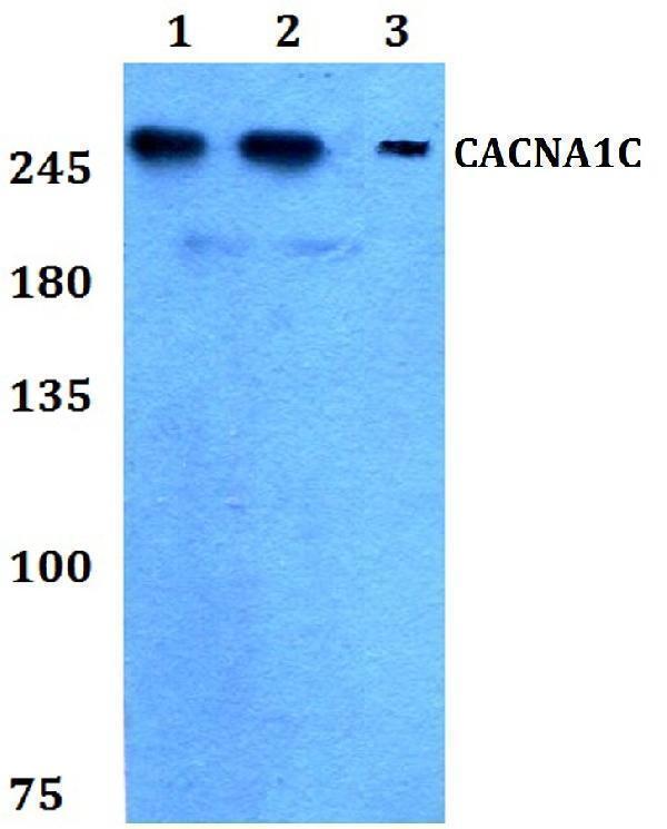 a00976 1 cacna1c primary antiboties wb testing 1