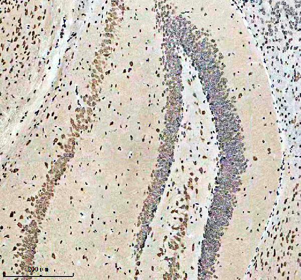 IHC analysis of CACNA1C using anti-CACNA1C antibody (A00976-2)
