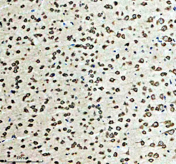 IHC analysis of CACNA1C using anti-CACNA1C antibody (A00976-2)