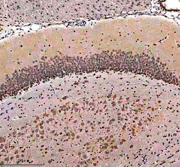 IHC analysis of CACNA1C using anti-CACNA1C antibody (A00976-2)