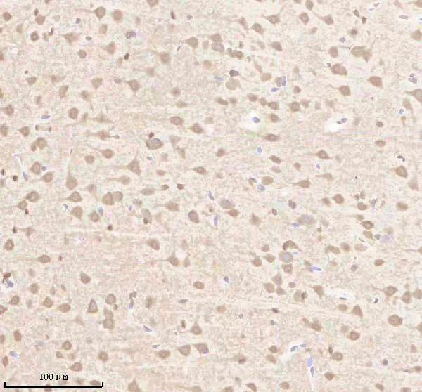 a00976 2 cacna1c primary antibodies ihc testing 4