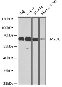 a00977 myoc primary antiboties wb testing 1