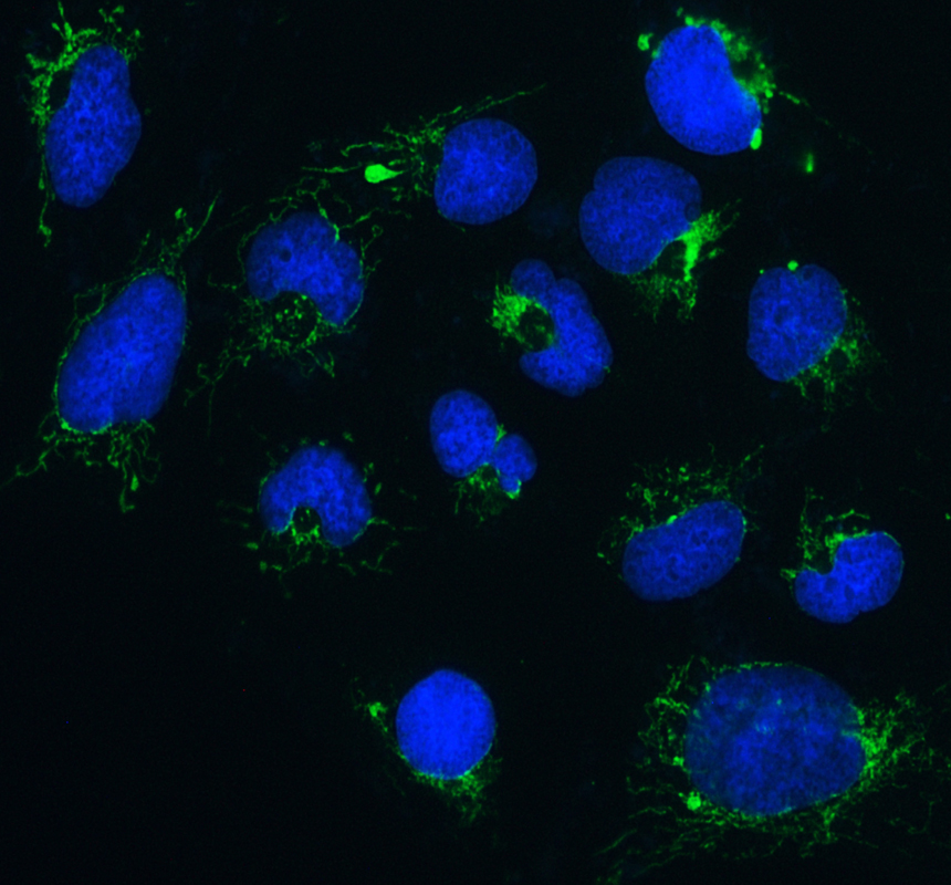 a00978 1 clpx primary antibodies if testing 1_1