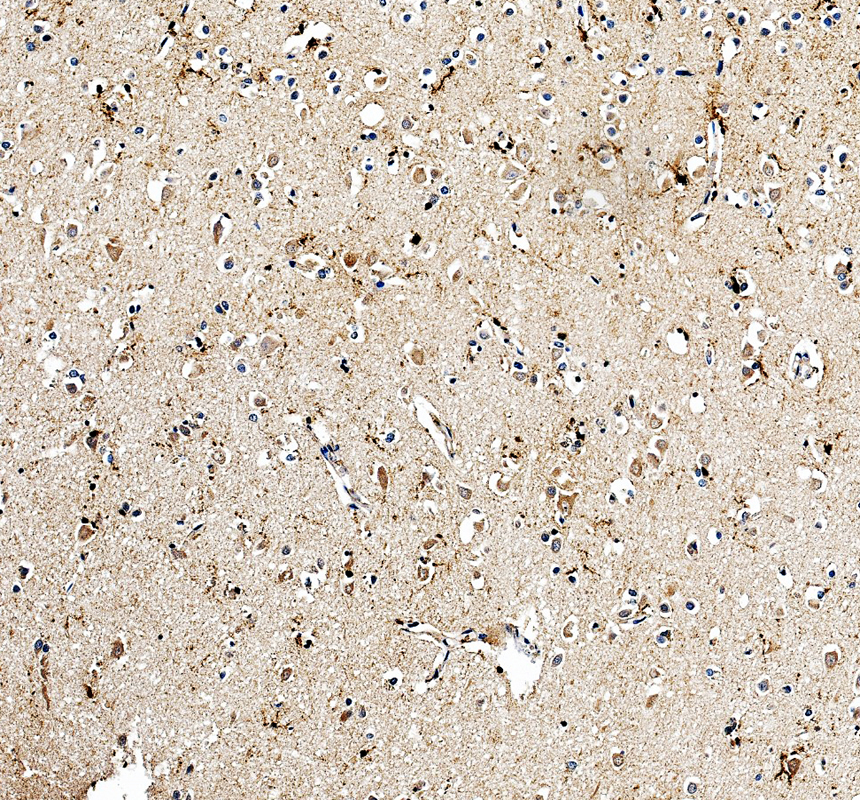 IHC analysis of CLPX using anti-CLPX antibody (A00978-1)
