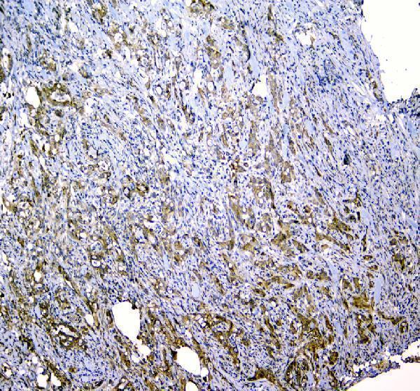 a00978 1 clpx primary antibodies ihc testing 2