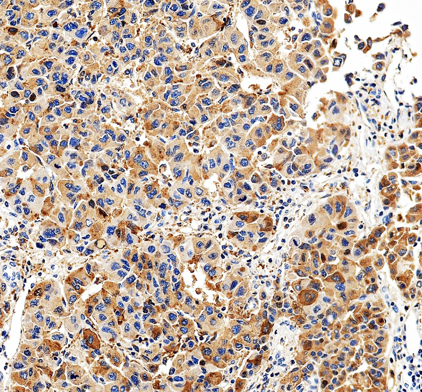 IHC analysis of CLPX using anti-CLPX antibody (A00978-1)