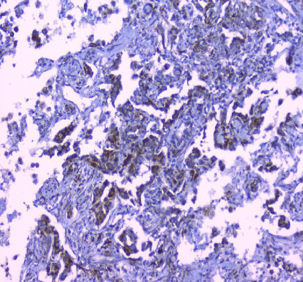 a00978 1 clpx primary antibodies ihc testing 3