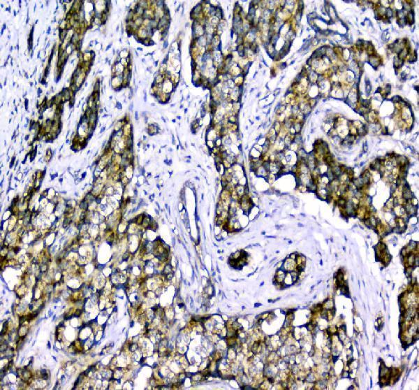 a00978 1 clpx primary antibodies ihc testing 4